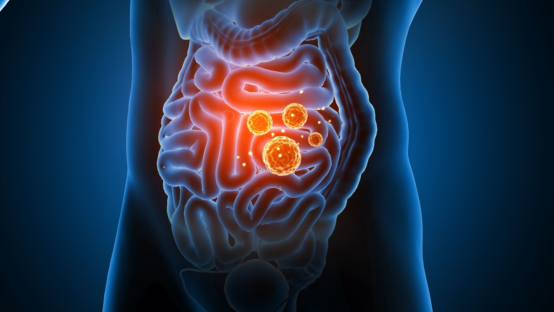 The Gut-Immune Axis: Why 70% of Your Immune System Lives in Your Digestive Tract